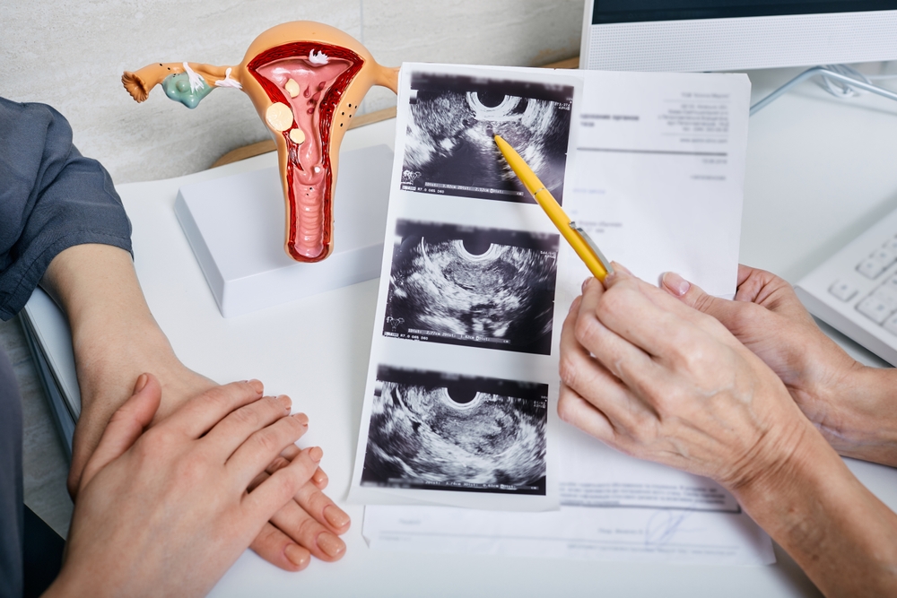 Gynecology,,Women's,Health.,Gynecologist,Showing,To,Woman,Ultrasound,Of,Her